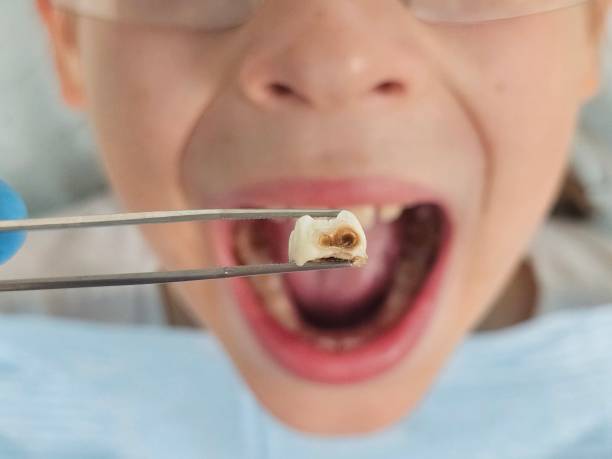Best Same-Day Emergency Dental Services in Ellport, PA